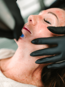 Black friday preview (35) Medical Grade Facials in Richmond VA